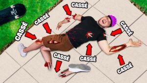 Je crois que je me suis cassé quelque chose..